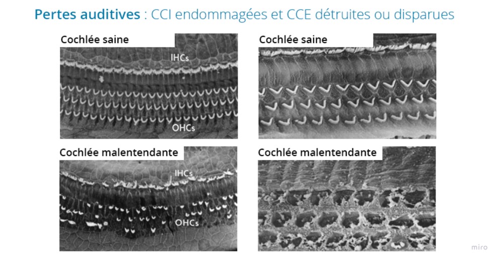 Cils