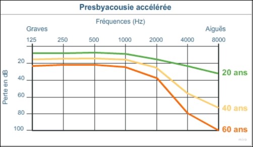 presby_acceleree
